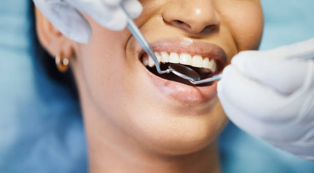 Best Root Canal Treatment  in Eslon, CA